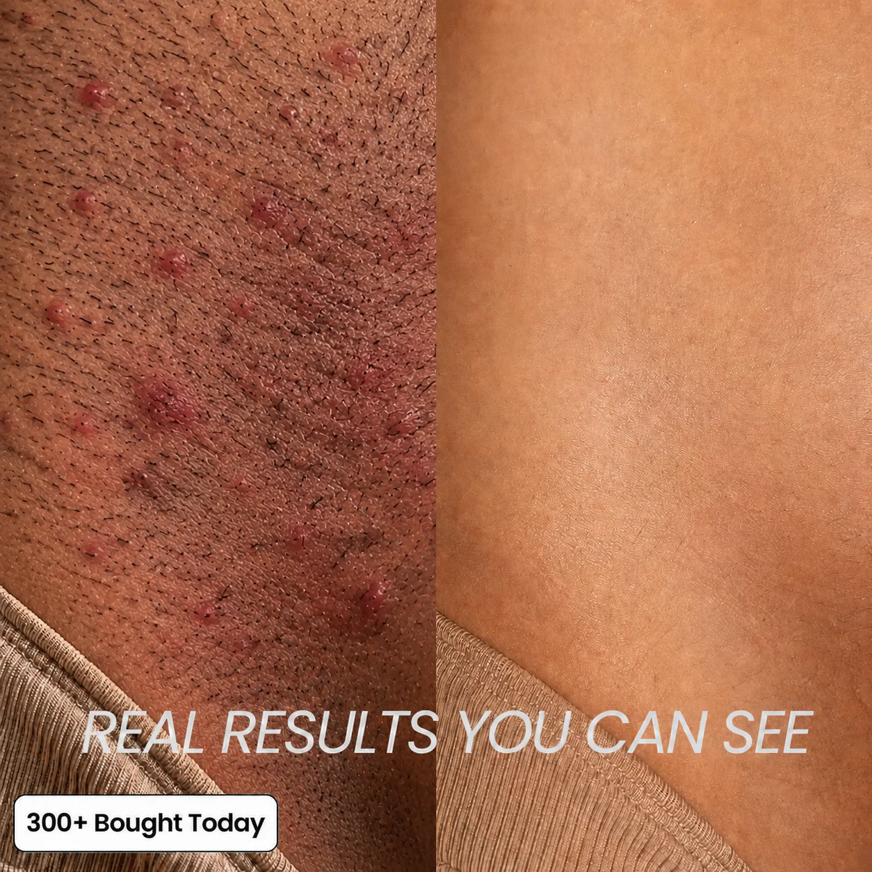 Anti-Hair Growth Oil - Image 6