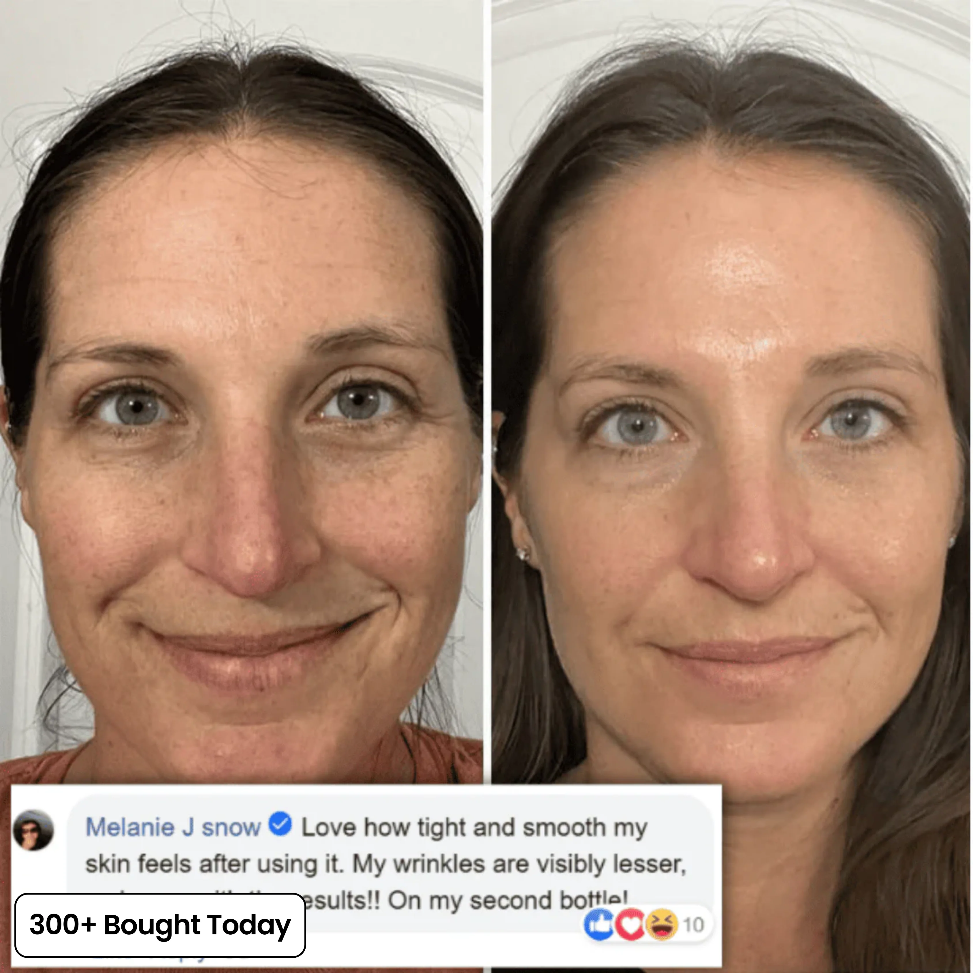 Collagen Plump & Repair Volufiline Balm - Image 10
